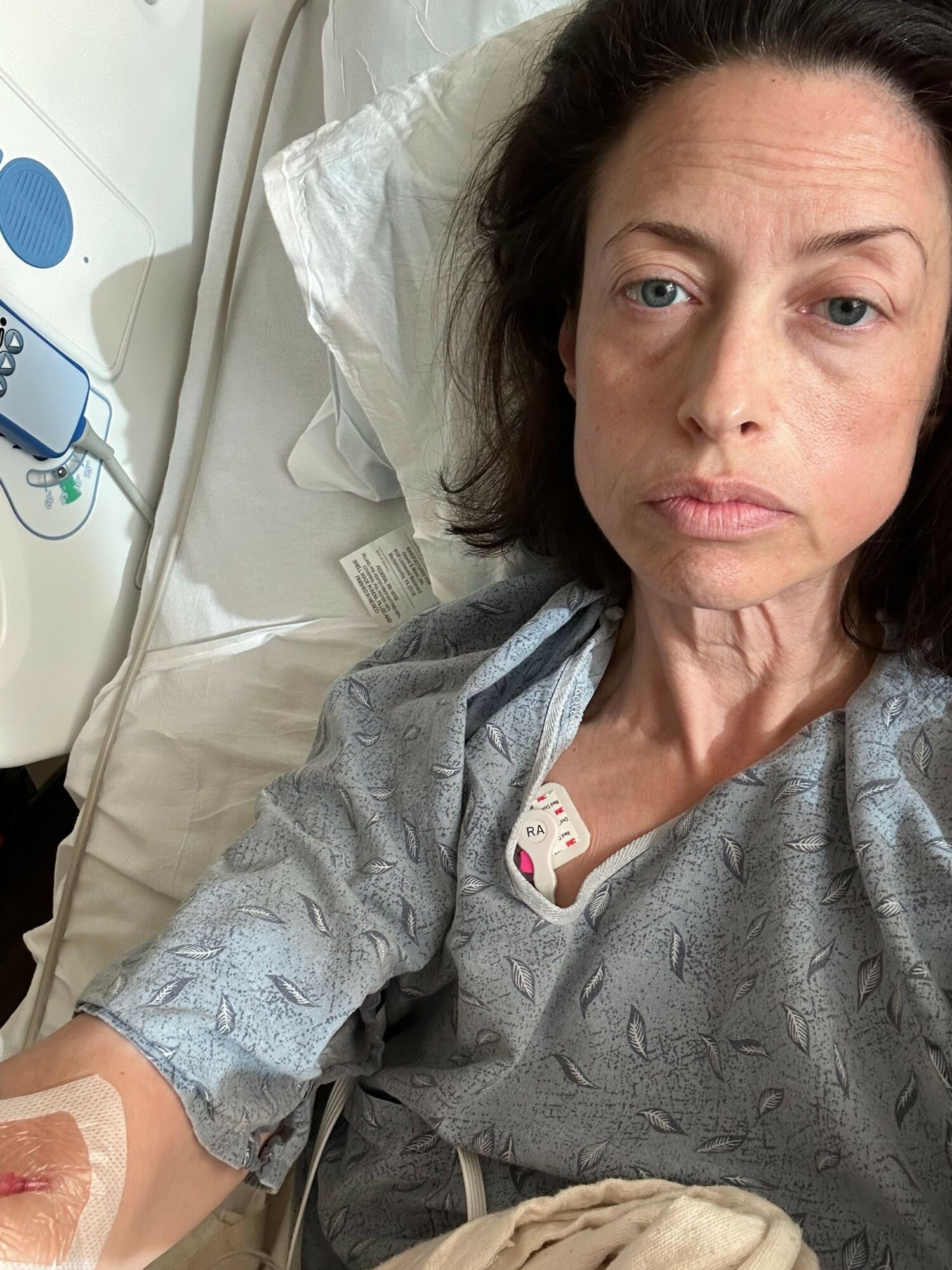 Woman lying in hospital bed with medical tubes and bandages, looking at the camera.