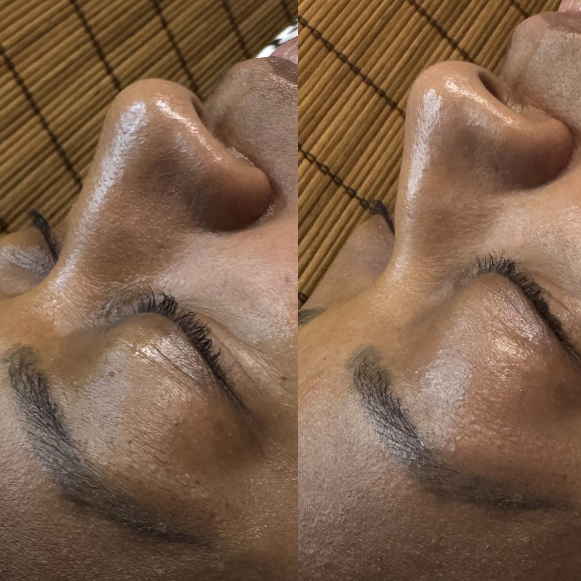 Close-up of a person's nose and closed eyes, showing a before and after comparison, with a bamboo mat background.