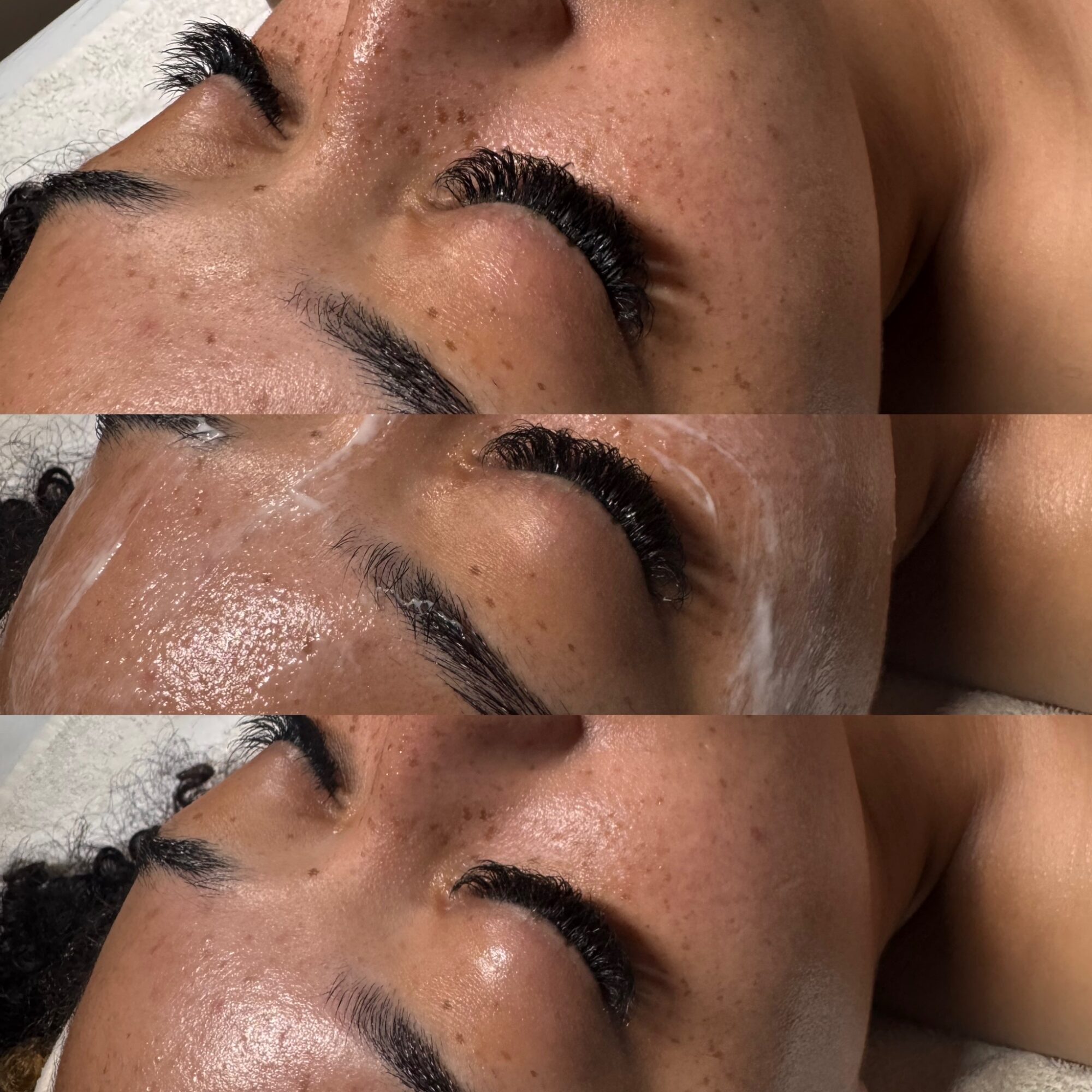 Close-up of a person's face with eyes closed, showing skin texture and eyebrows, with a skincare treatment being applied.